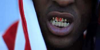 YNG feat. J. Nics - A-1 Since Day 1 video