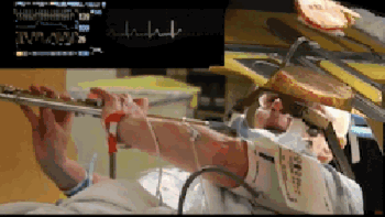 Atmosphere - Blotter Acid Reflux Syndrome video